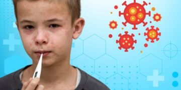 অত্যন্ত সংক্রামক রোগ হাম, জানুন লক্ষণ ও প্রতিরোধে করণীয়