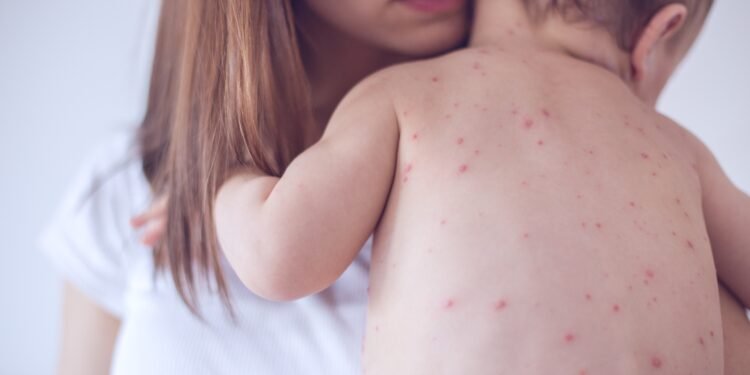 হামে আ/ক্রা/ন্ত হয়ে গত ২৪ ঘণ্টায় আরও ৭ জনের মৃ/ত্যু
বিস্তারিত: 
#news #banglaflow #বাংলাফ্লো