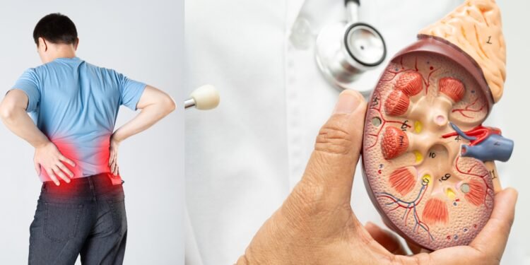 নীরবে শরীরে বাসা বাঁধে কিডনি রোগ