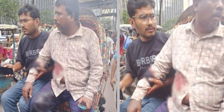 প্রকাশ্য দিবালোকে মতিঝিলে ব্যবসায়ীকে গুলি করে বিদেশি মুদ্রা ছিনতাই
