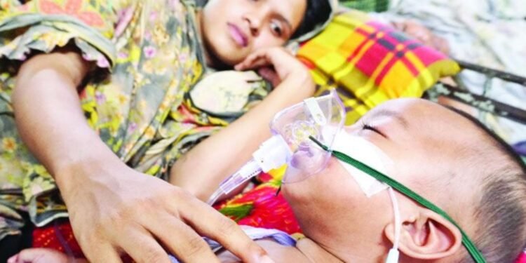 হাম ও উপসর্গে দেশে ৯০৮ শিশুর মৃ/ত্যু